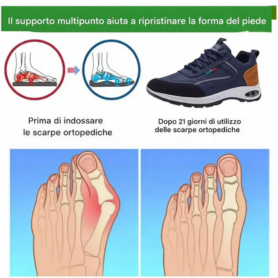🎉 Ultimo giorno! 60% di sconto! ✅ Scarpe ortopediche progettate appositamente per chi soffre di problemi ai piedi, per sostenere l'arco plantare e contribuire ad alleviare i dolori alla schiena, alle articolazioni e ai piedi.